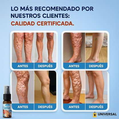 2 x 1 Veni X™ — ¡Dile adiós a las venas varices! 2x1